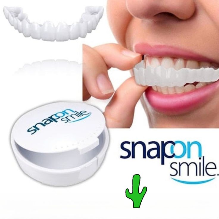 Prothèse dentaire - snapon smile